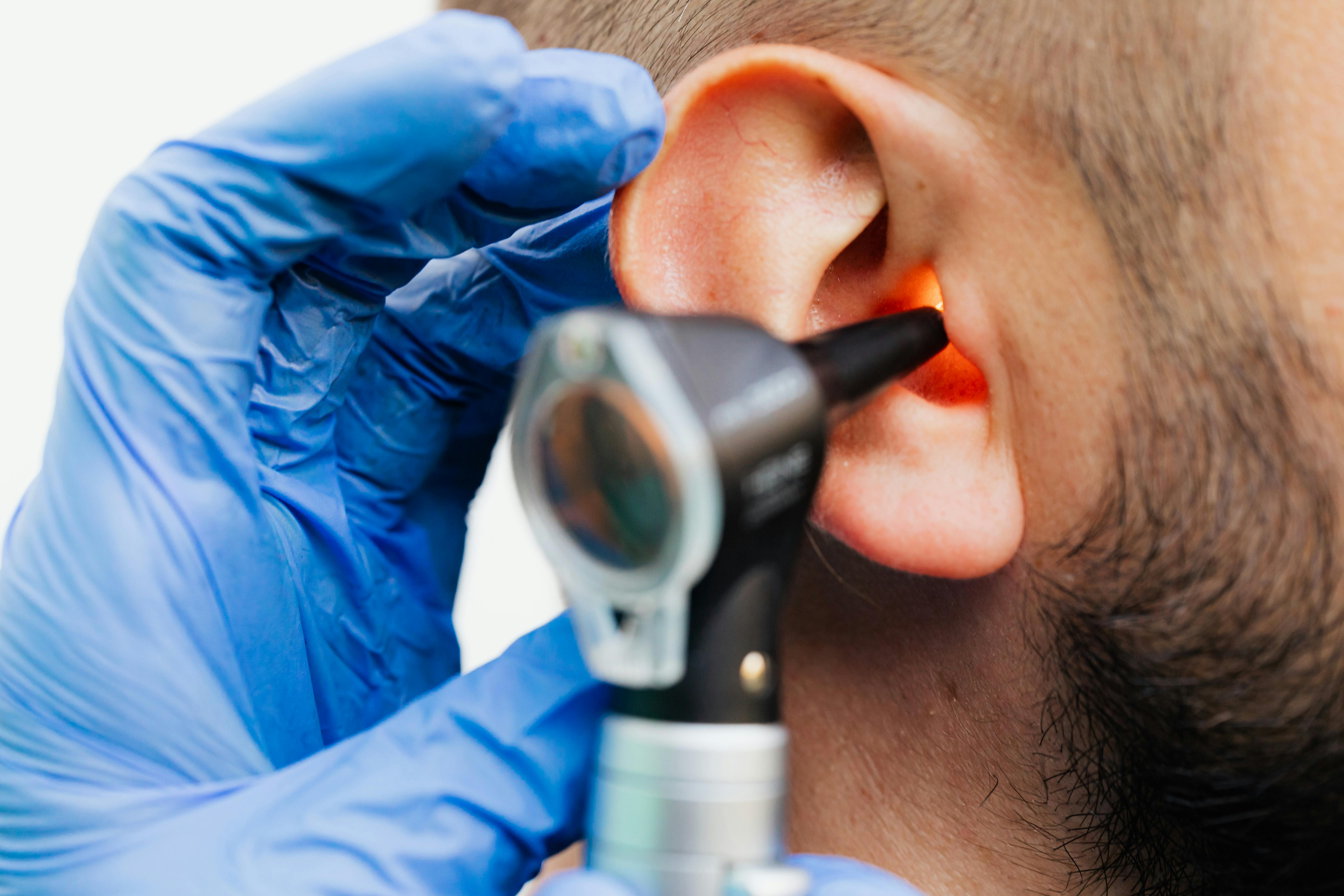 ENT Otorhinolaryngology