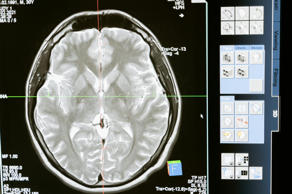 Neurology
